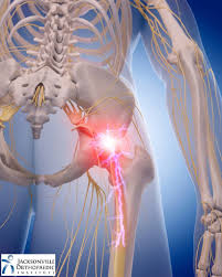 Joint Pain